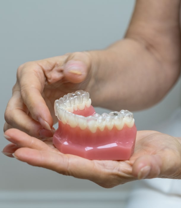 A photo of jaw model with clear aligner