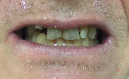 A close up photo before 