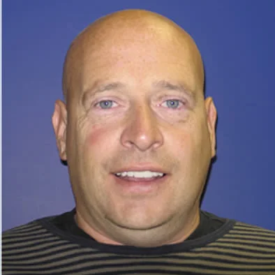 A photo of smile after