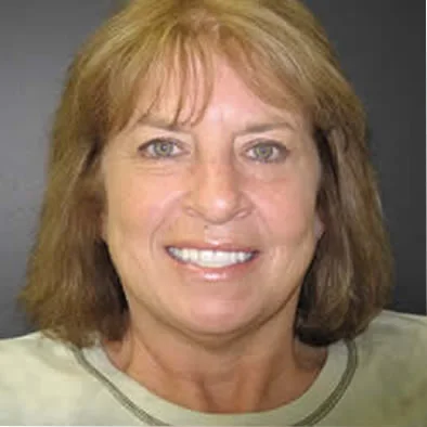 A photo of smile after