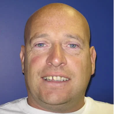 A close up photo before 