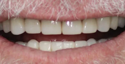 A photo of smile after