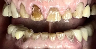 A close up phot before 