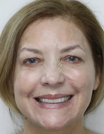 A photo of our happy client after procedure