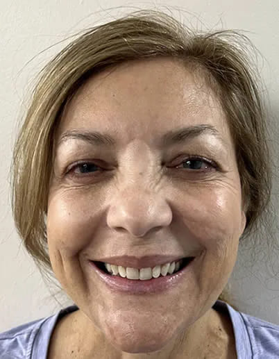 A photo of our happy client before procedure