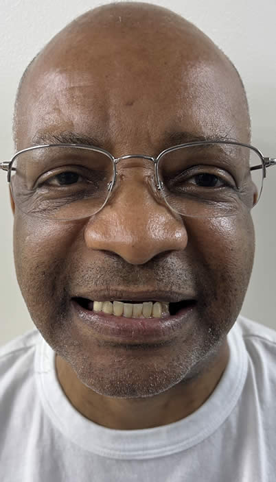 A photo of our happy client before procedure