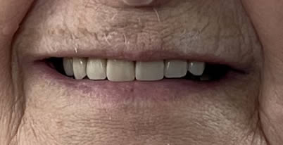 A photo of smile after