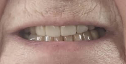 A close up phot before 