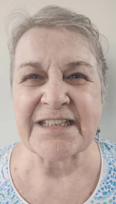 A photo of our happy client before procedure