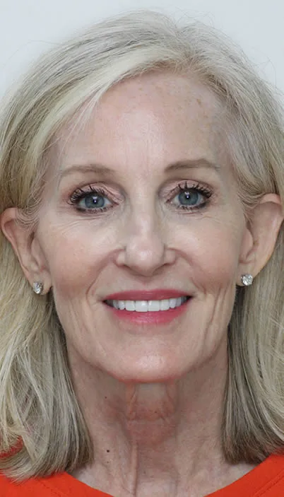 A photo of our happy client after procedure