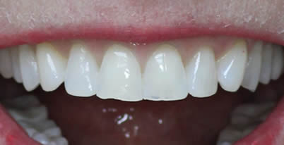 A close up phot before 