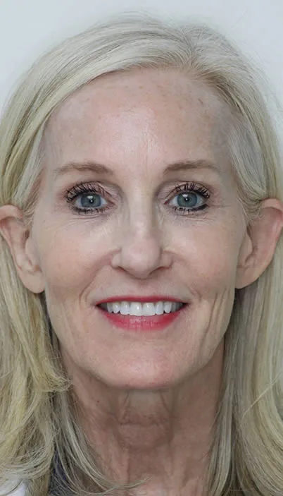 A photo of our happy client before procedure