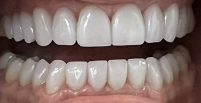 A photo of smile after