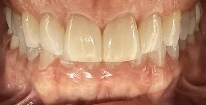 A close up phot before 